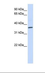 Fetal heart lysate. Antibody concentration: 1.0 ug/ml. Gel concentration: 12%.