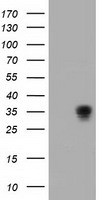 HEK293T cells were transfected with the pCMV6-ENTRY control (Left lane) or pCMV6-ENTRY ACY3 (Right lane) cDNA for 48 hrs and lysed. Equivalent amounts of cell lysates (5 ug per lane) were separated by SDS-PAGE and immunoblotted with anti-ACY3.