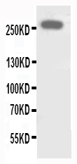 WB of ABCA4 antibody. All lanes: Anti-ABCA4 at 0.5ug/ml. WB: SHG Whole Cell Lysate at 40ug. Predicted bind size: 256KD. Observed bind size: 256KD.