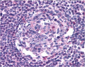 Immunohistochemistry of CCR5 in human lymph node tissue with CCR5 antibody at 20 ug/ml.
