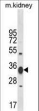 Western blot of ACY3 Antibody in mouse kidney tissue lysates (35 ug/lane). ACY3 (arrow) was detected using the purified antibody.