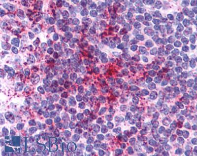 Anti-CCR6 antibody LS-A355 IHC of human tonsil. Immunohistochemistry of formalin-fixed, paraffin-embedded tissue after heat-induced antigen retrieval.