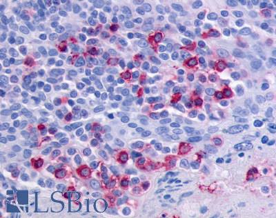 Anti-CCR6 antibody LS-A356 IHC of human tonsil. Immunohistochemistry of formalin-fixed, paraffin-embedded tissue after heat-induced antigen retrieval.