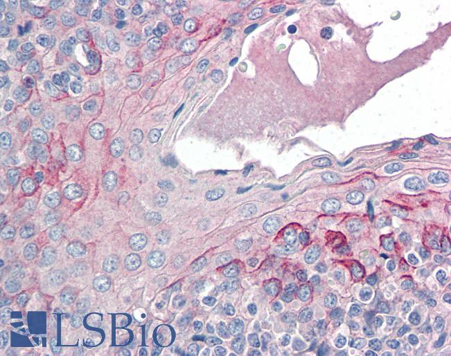 Anti-CCR6 antibody IHC of human tonsil. Immunohistochemistry of formalin-fixed, paraffin-embedded tissue after heat-induced antigen retrieval. Antibody LS-B2481 concentration 5 ug/ml.
