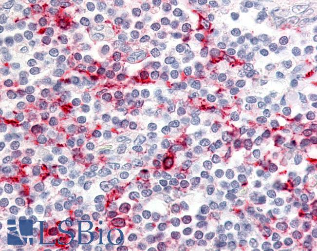 Anti-CCR6 antibody LS-A358 IHC of human tonsil. Immunohistochemistry of formalin-fixed, paraffin-embedded tissue after heat-induced antigen retrieval.