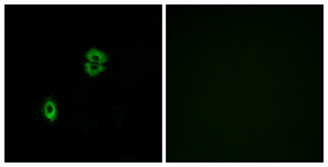 Immunofluorescence of A549 cells, using CCR7 Antibody. The picture on the right is treated with the synthesized peptide.