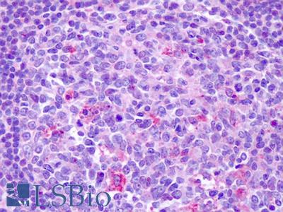 Anti-CCR7 antibody IHC of human tonsil. Immunohistochemistry of formalin-fixed, paraffin-embedded tissue after heat-induced antigen retrieval. Antibody LS-A848 dilution 14 ug/ml.