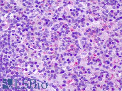 Anti-CCR7 antibody IHC of human spleen. Immunohistochemistry of formalin-fixed, paraffin-embedded tissue after heat-induced antigen retrieval. Antibody LS-A848 dilution 14 ug/ml.