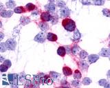HEK293 expressing transfected CCR7