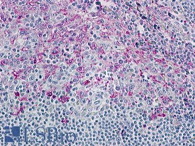 Anti-CCR8 antibody LS-A360 IHC of human tonsil. Immunohistochemistry of formalin-fixed, paraffin-embedded tissue after heat-induced antigen retrieval.