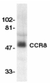 Western blot of CCR8 in human spleen lysate with CCR8 antibody at 1:500 dilution.