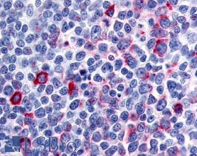 Anti-CCR8 antibody LS-A359 IHC of human tonsil, germinal center. Immunohistochemistry of formalin-fixed, paraffin-embedded tissue after heat-induced antigen retrieval.