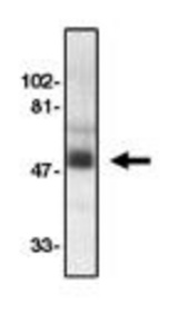 Western blot of anti-CCR8 (EL) antibody at 1 ug/ml on human spleen tissue lysates