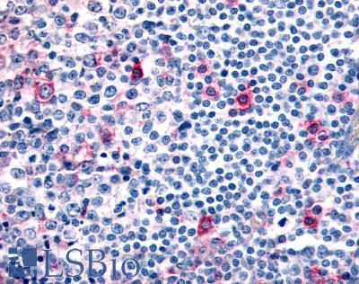 Anti-CCR8 antibody LS-A3845 IHC of human tonsil, germinal center and mantle zone. Immunohistochemistry of formalin-fixed, paraffin-embedded tissue after heat-induced antigen retrieval.