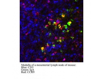 Immunocytochemistry of CCR9 antibody LS-C82337.