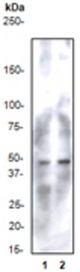 Western blot analysis on (1) K562 and (2) Daudi cell lysates using anti-CKR9/CCR9 (N-term) antibody, dilution 1:500.