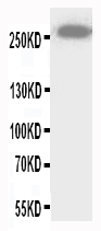 WB of ABCA4 antibody. All lanes: Anti-ABCA4 at 0.5ug/ml. WB: Mouse Brain Tissue Lysate at 40ug. Predicted bind size: 256KD. Observed bind size: 256KD.