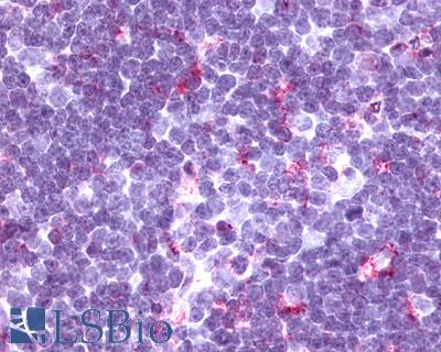 Anti-CCR9 antibody LS-A961 IHC of human thymus, lymphocytes. Immunohistochemistry of formalin-fixed, paraffin-embedded tissue after heat-induced antigen retrieval.