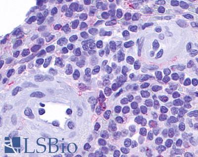 Anti-CCRL2 antibody LS-A1094 IHC of human spleen. Immunohistochemistry of formalin-fixed, paraffin-embedded tissue after heat-induced antigen retrieval.