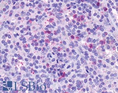 Anti-CCRL2 antibody LS-A1093 IHC of human spleen. Immunohistochemistry of formalin-fixed, paraffin-embedded tissue after heat-induced antigen retrieval.