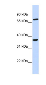 CCRL2 antibody LS-C101475 Western blot of 721_B cell lysate.