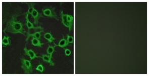 Immunofluorescence of COS7 cells, using CCRL2 Antibody. The picture on the right is treated with the synthesized peptide.