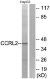 Western blot of extracts from HepG2 cells, using CCRL2 Antibody. The lane on the right is treated with the synthesized peptide.