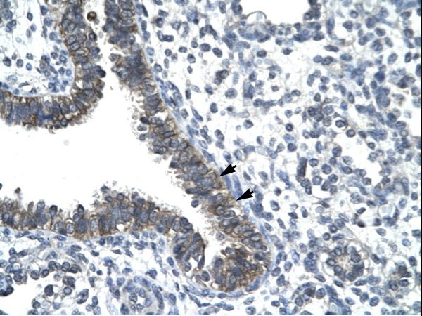 CCRN4L antibody LS-C31030 was used in IHC to stain formalin-fixed, paraffin-embedded human lung.