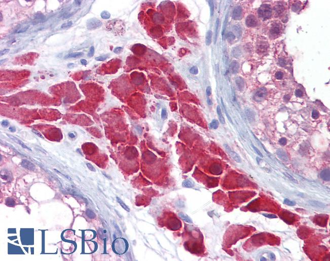 Anti-CCS antibody IHC of human testis. Immunohistochemistry of formalin-fixed, paraffin-embedded tissue after heat-induced antigen retrieval. Antibody LS-B6256 dilution 1:200.