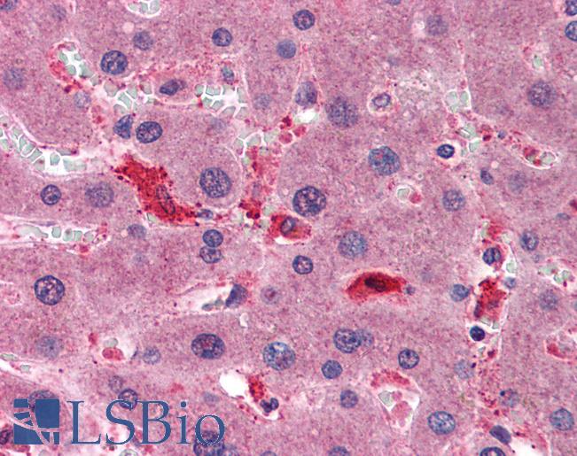 Anti-CCS antibody IHC of human liver. Immunohistochemistry of formalin-fixed, paraffin-embedded tissue after heat-induced antigen retrieval. Antibody LS-B6202 concentration 1.5 ug/ml.