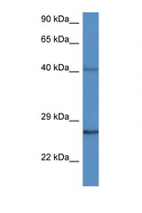 CCS antibody LS-C145613 Western blot of 435S Cell lysate. Antibody concentration 1 ug/ml.