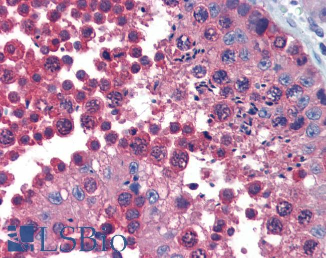 Anti-CCT2 antibody IHC of human testis. Immunohistochemistry of formalin-fixed, paraffin-embedded tissue after heat-induced antigen retrieval. Antibody LS-B3740 concentration 10 ug/ml.
