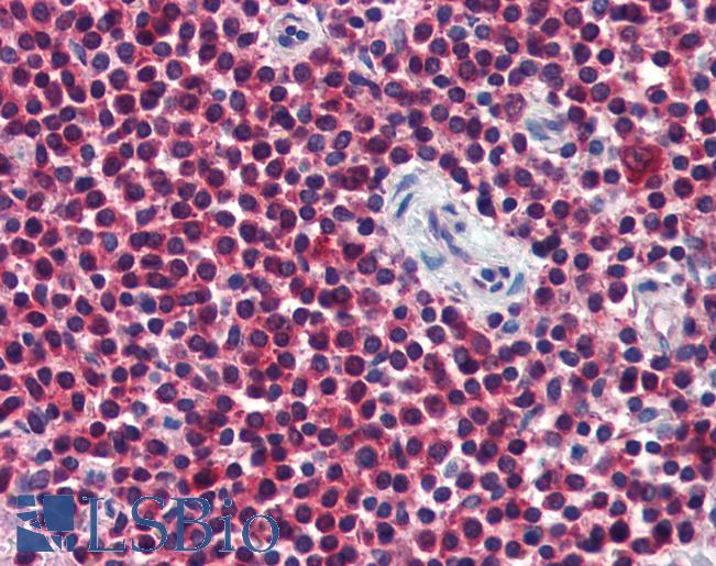 Anti-CCT2 antibody IHC of human spleen. Immunohistochemistry of formalin-fixed, paraffin-embedded tissue after heat-induced antigen retrieval. Antibody LS-B3740 concentration 10 ug/ml.