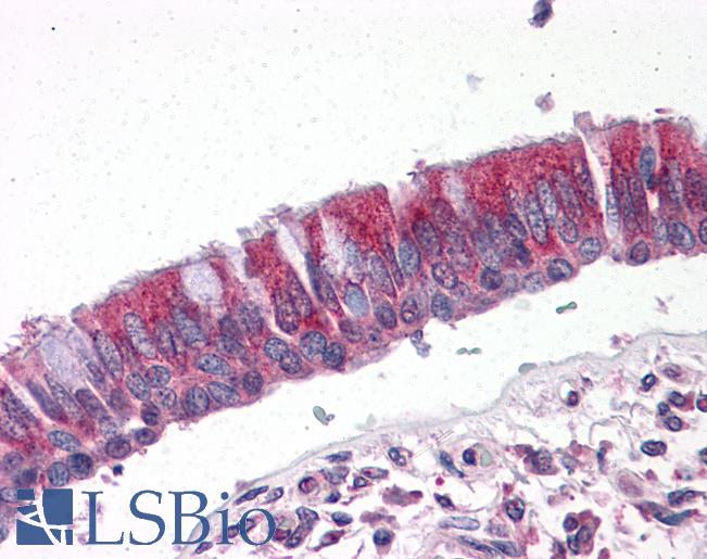 Anti-CCT2 antibody IHC of human lung, respiratory epithelium. Immunohistochemistry of formalin-fixed, paraffin-embedded tissue after heat-induced antigen retrieval. Antibody LS-B4861 concentration 10 ug/ml.