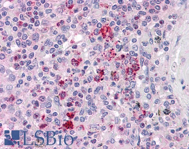 Anti-CCT2 antibody IHC of human spleen. Immunohistochemistry of formalin-fixed, paraffin-embedded tissue after heat-induced antigen retrieval. Antibody LS-B4861 concentration 10 ug/ml.