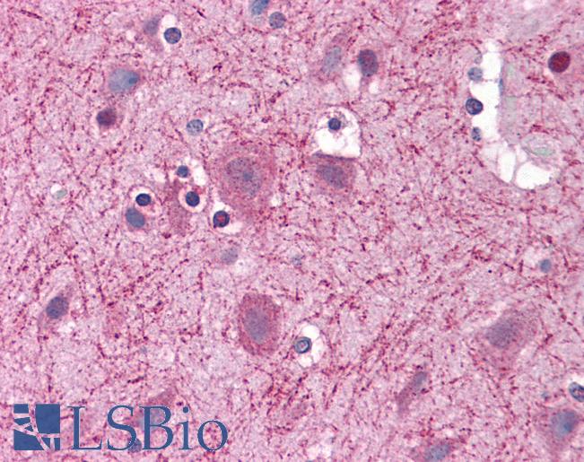 Anti-CCT2 antibody IHC of human brain, cortex. Immunohistochemistry of formalin-fixed, paraffin-embedded tissue after heat-induced antigen retrieval. Antibody LS-B4861 concentration 10 ug/ml.