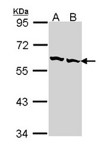 Sample (30 ug of whole cell lysate). A: Hep G2. B: Raji. 7.5% SDS PAGE. CCT2 antibody diluted at 1:1000.