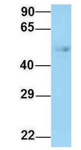 CCT Beta / CCT2 antibody Western Blot of Human Fetal Lung. Antibody Dilution: 1.0 ug/ml. Antibody dilution: 1 ug/ml.