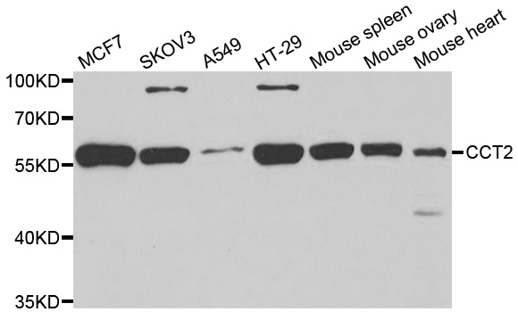 Western blot analysis of extracts of various cell lines, using CCT2 antibody.