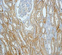 IHC of paraffin-embedded human kidney tissue using anti-TCP1 beta antibody.
