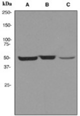 Western blot analysis on (A) HeLa, (B) MCF-7, and (C) A431 cell lysates using anti-TCP1 beta antibody.