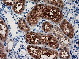 IHC of paraffin-embedded Human Kidney tissue using anti-ACY3 mouse monoclonal antibody.