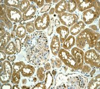 IHC of paraffin-embedded human kidney tissue using anti-TCP1 beta antibody (LS-C105760).