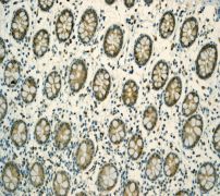 IHC of paraffin-embedded human colon tissue using anti-TCP1 beta antibody (LS-C105760).