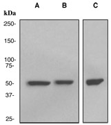 Western blot analysis on (A) HeLa, (B) MCF-7, and (C) Daudi cell lysates using anti-TCP1 beta antibody (LS-C105760).