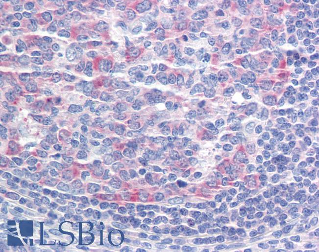 Anti-CCT3 antibody IHC staining of human tonsil. Immunohistochemistry of formalin-fixed, paraffin-embedded tissue after heat-induced antigen retrieval.
