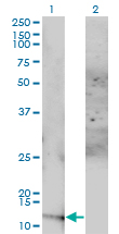 Western Blot analysis of ACYP1 expression in transfected 293T cell line by ACYP1 monoclonal antibody (M01), clone 1B2-3A2.Lane 1: ACYP1 transfected lysate(11.3 KDa).Lane 2: Non-transfected lysate.