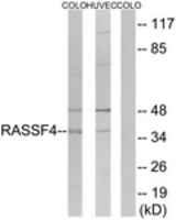 Western blot of extracts from COLO/HUVEC cells, using RASSF4 Antibody. The lane on the right is treated with the synthesized peptide.