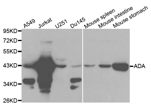 Western blot analysis of extracts of various cell lines, using ADA antibody.