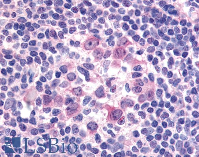 Anti-FLT3 / CD135 antibody LS-A7147 IHC of human tonsil. Immunohistochemistry of formalin-fixed, paraffin-embedded tissue after heat-induced antigen retrieval.